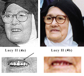 The impostor Sister Lucy's false teeth 1