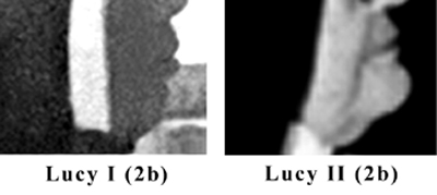 Chin profile comparison of the Real Sister Lucia and the fake sister lucy